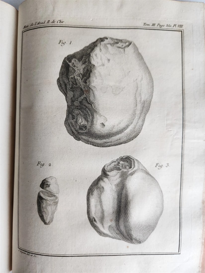 1753 SURGERY ANATOMY ILLUSTRATED antique Memoires l'Academie Royale de Chirurgie - 11