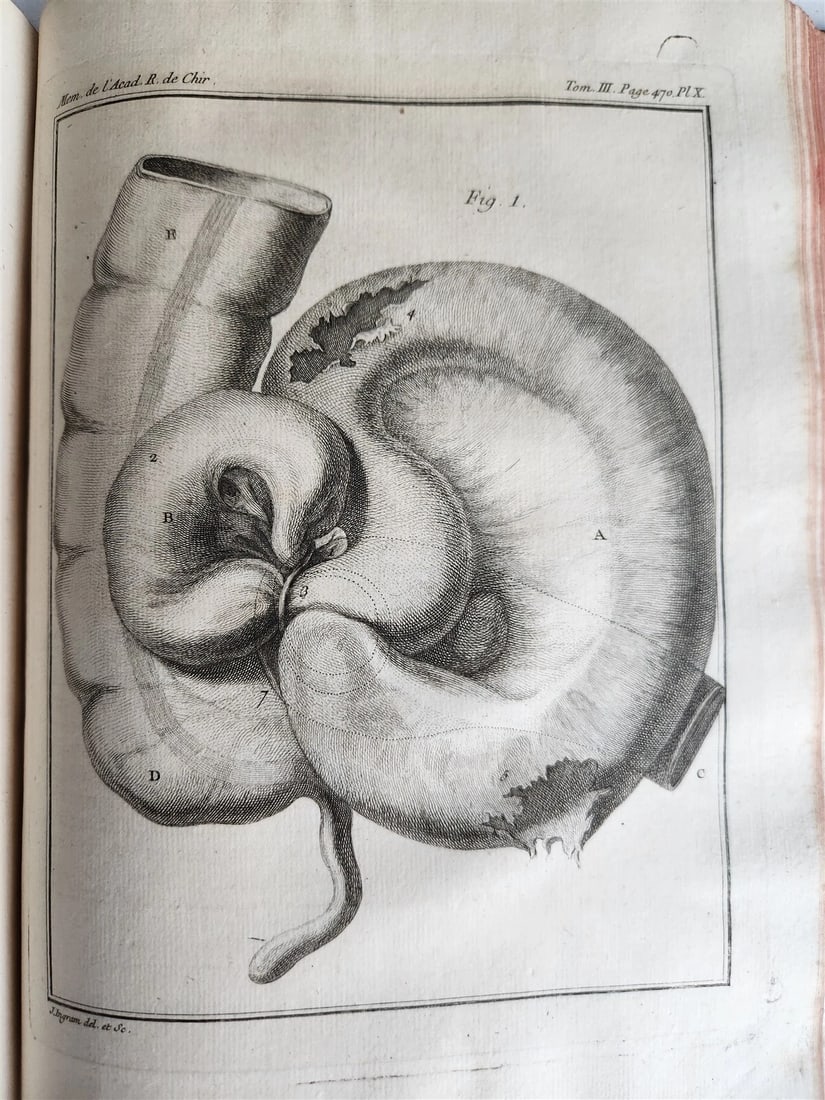 1753 SURGERY ANATOMY ILLUSTRATED antique Memoires l'Academie Royale de Chirurgie - 13