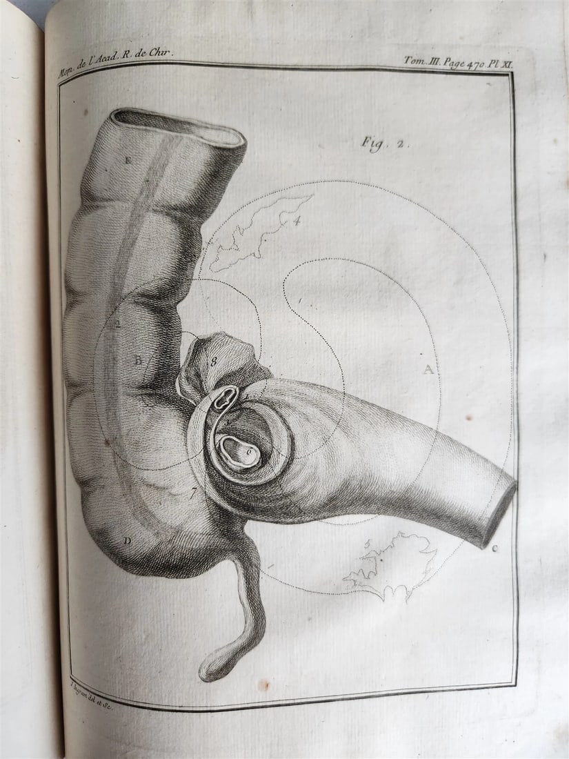 1753 SURGERY ANATOMY ILLUSTRATED antique Memoires l'Academie Royale de Chirurgie - 14