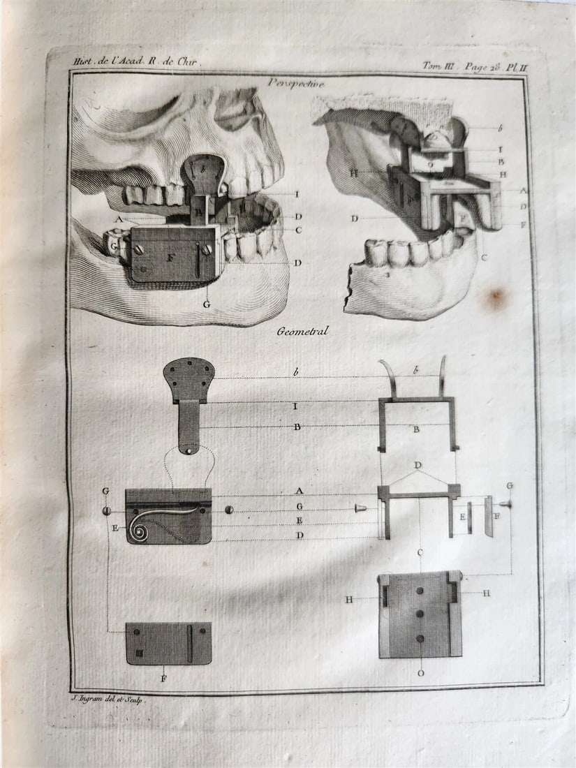 1753 SURGERY ANATOMY ILLUSTRATED antique Memoires l'Academie Royale de Chirurgie - 6