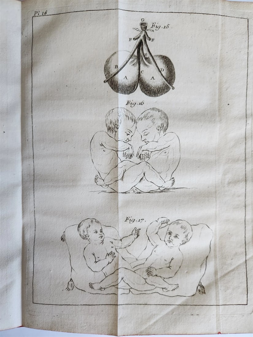 1748 MEDICAL TREATISE ILLUSTRATED ANATOMY by Francois PLANQUE antique V. 1 - 14