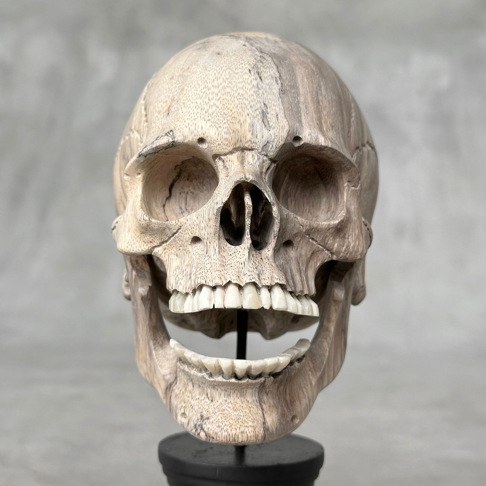 Wonderful human skull with a beautiful grain on a custom stand - 5