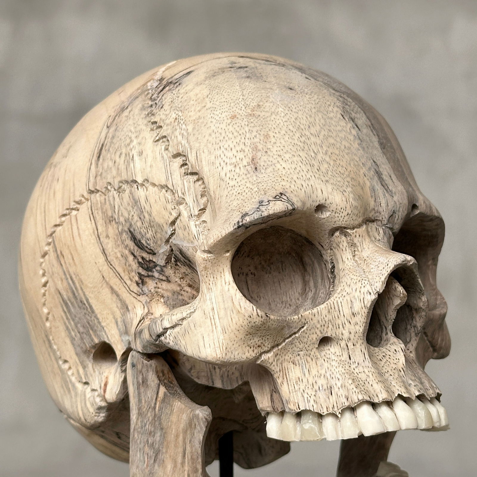 Wonderful human skull with a beautiful grain on a custom stand - 9