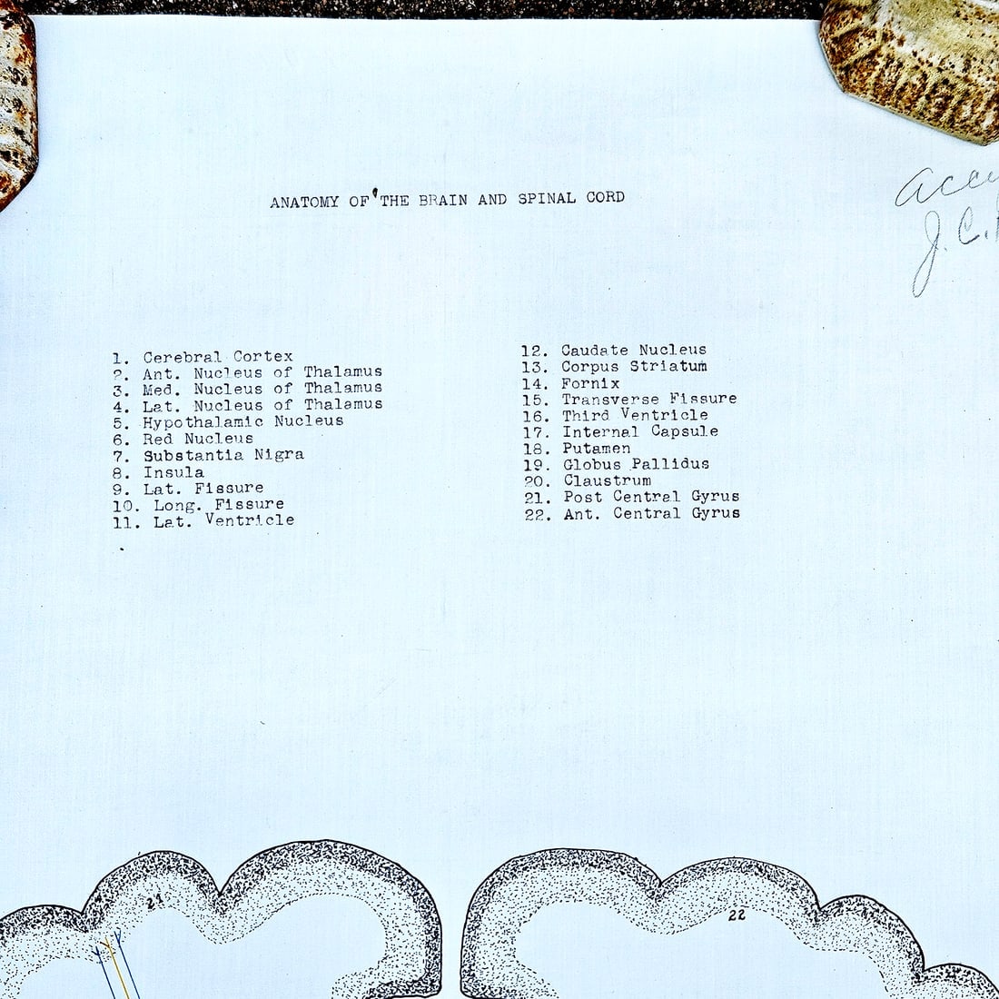 Vintage Pull-down Canvas Neuro Chart entitled “Anatomy of the Brain and Spinal Cord” - 2