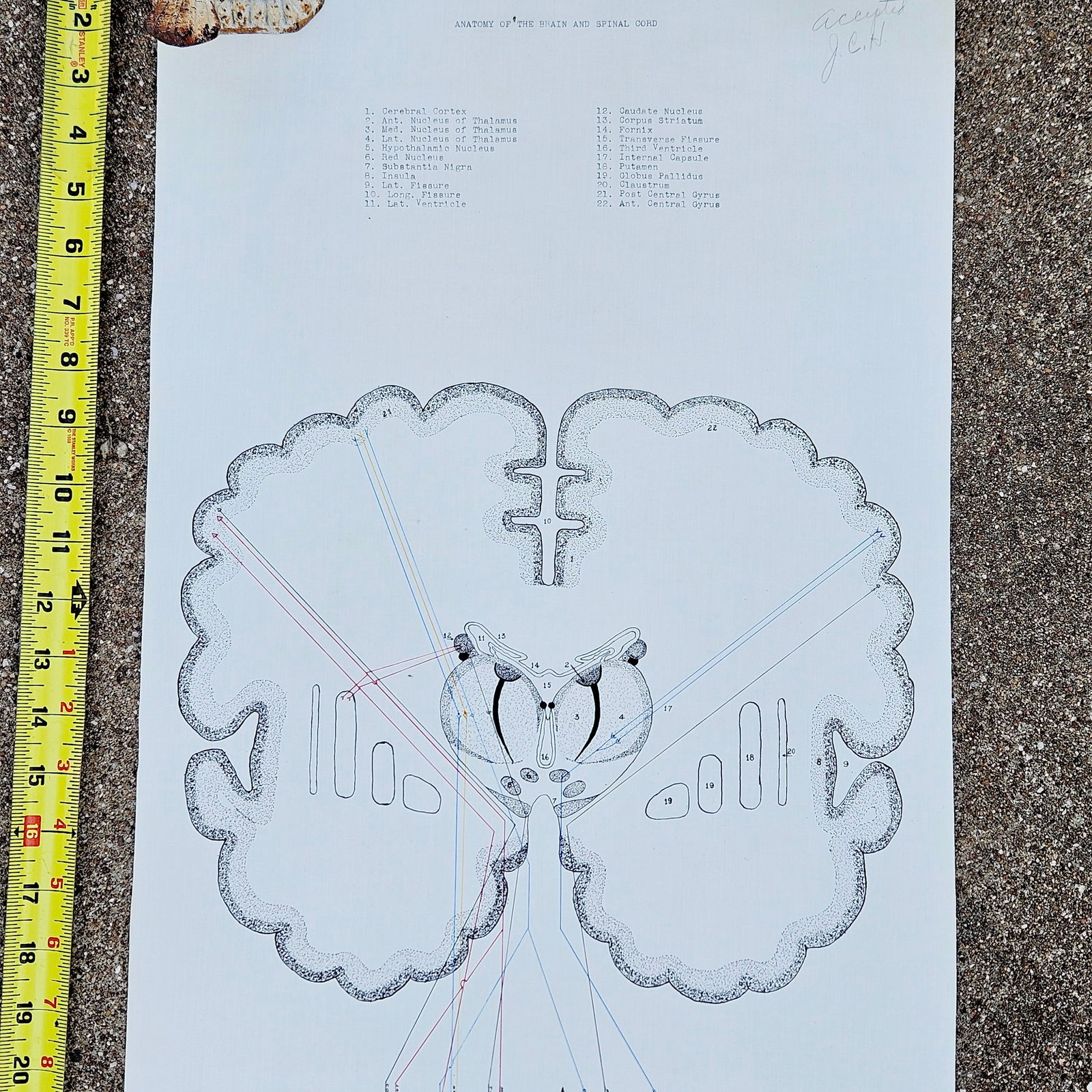 Vintage Pull-down Canvas Neuro Chart entitled “Anatomy of the Brain and Spinal Cord” - 3