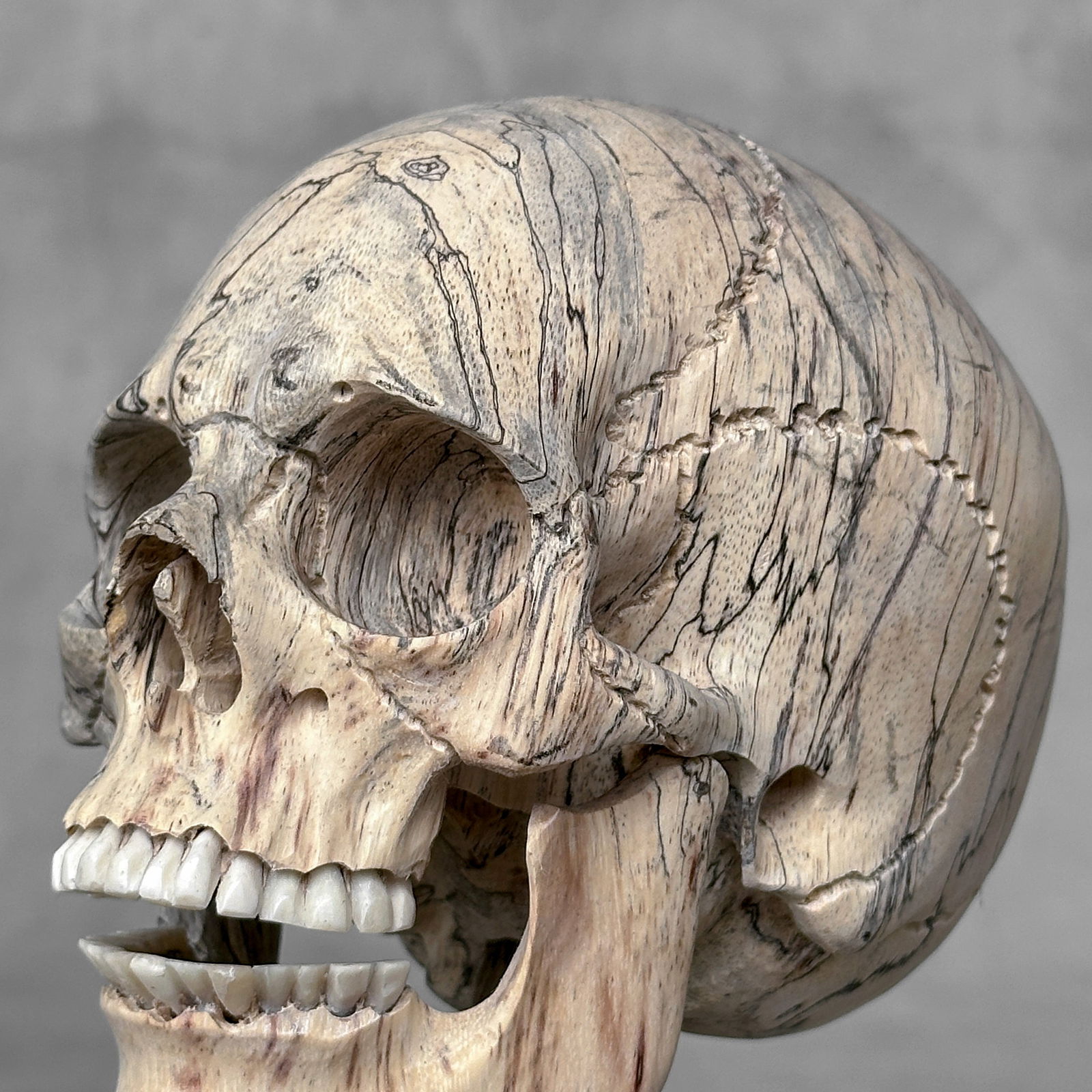 Wonderful human skull with a beautiful grain on a custom stand - 3