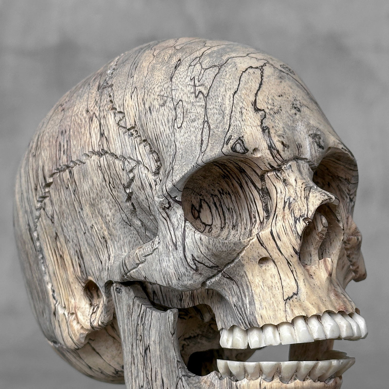 Wonderful human skull with a beautiful grain on a custom stand - 9