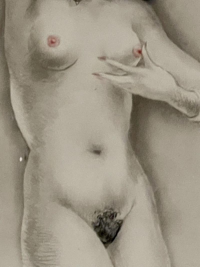 Hand Colored by Louis Icart: Slightly Swollen Areola. Authenticated - 7
