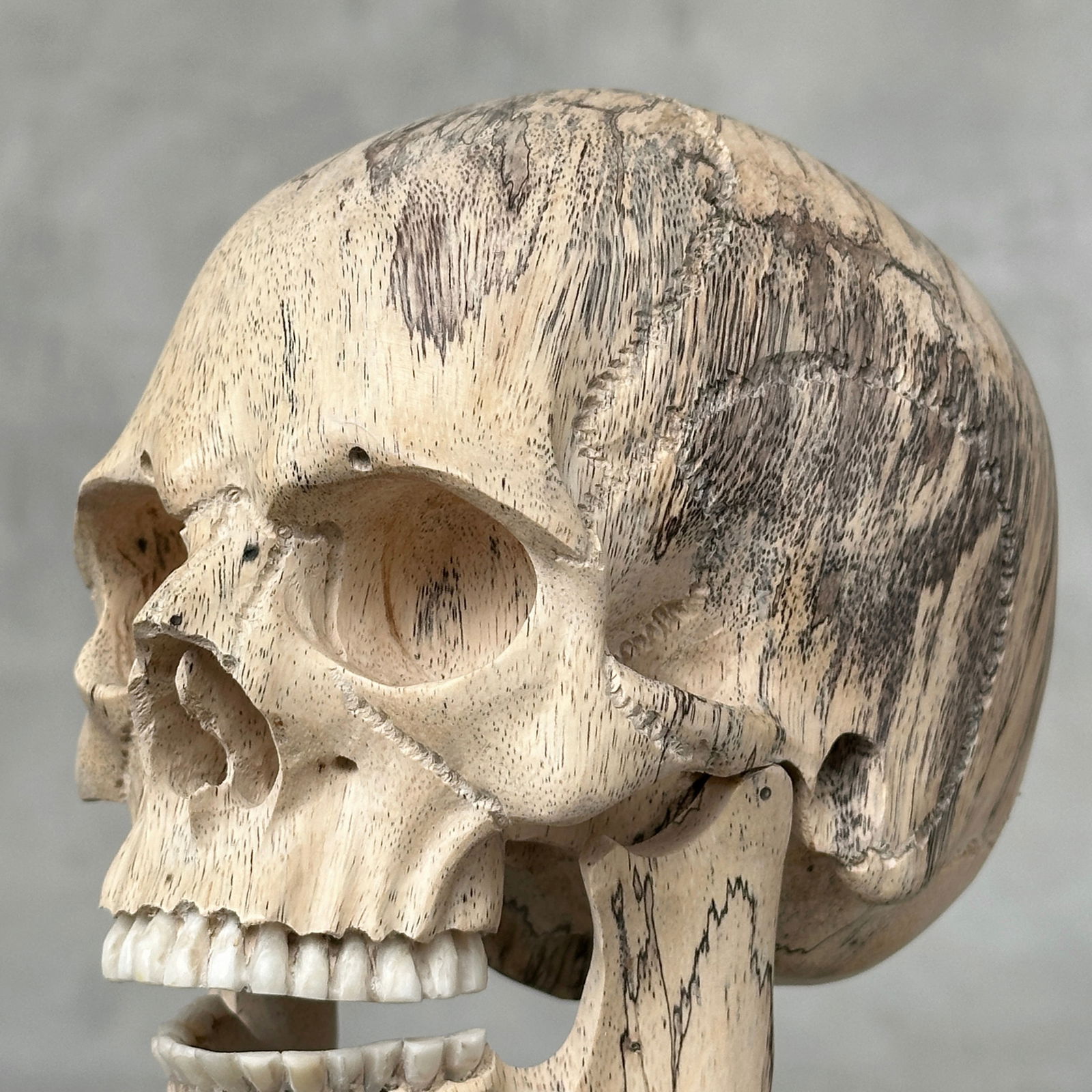 Stunning human skull with a beautiful grain on a custom stand - 3