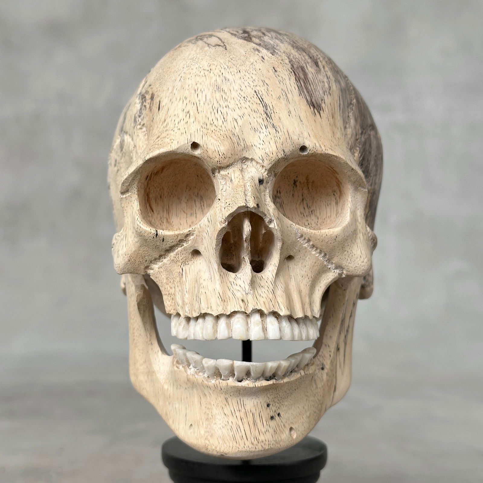 Stunning human skull with a beautiful grain on a custom stand - 5