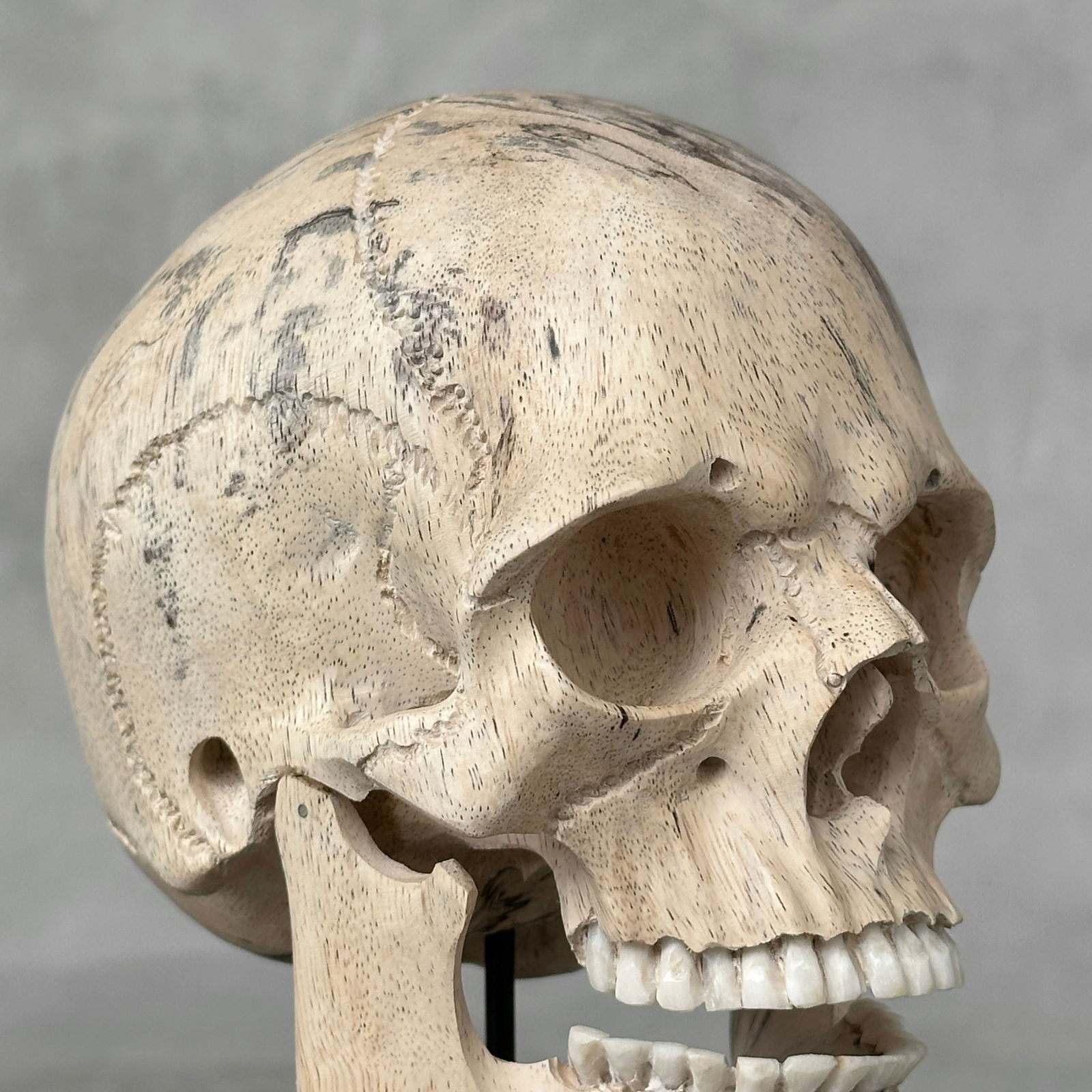 Stunning human skull with a beautiful grain on a custom stand - 9