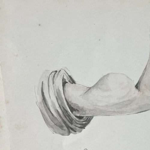 Antique Drawing Original Medecin, Doctor, Lipoma 19th century 1840 - 6