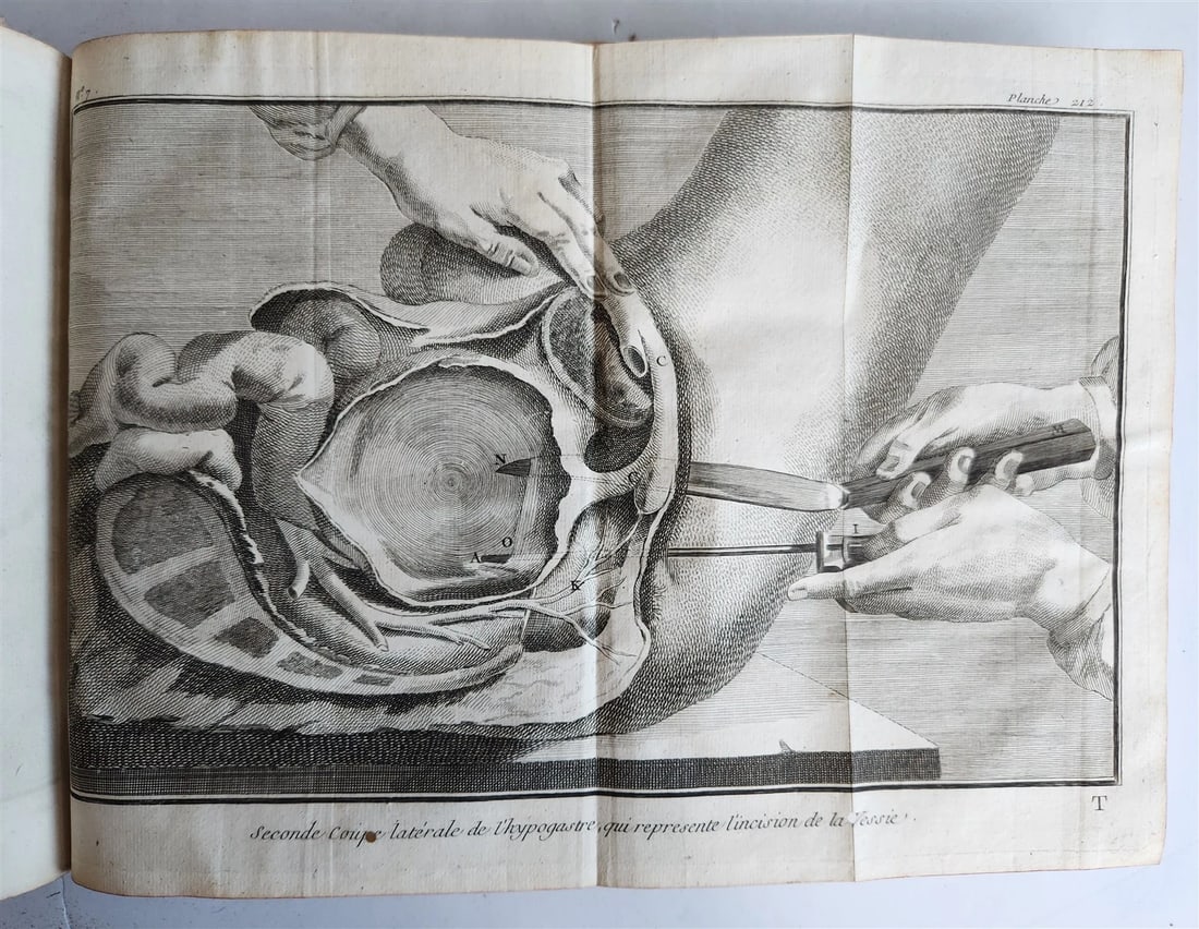 1770 MEDICAL TREATISE ILLUSTRATED ANATOMY by Francois PLANQUE antique V. 10 - 3