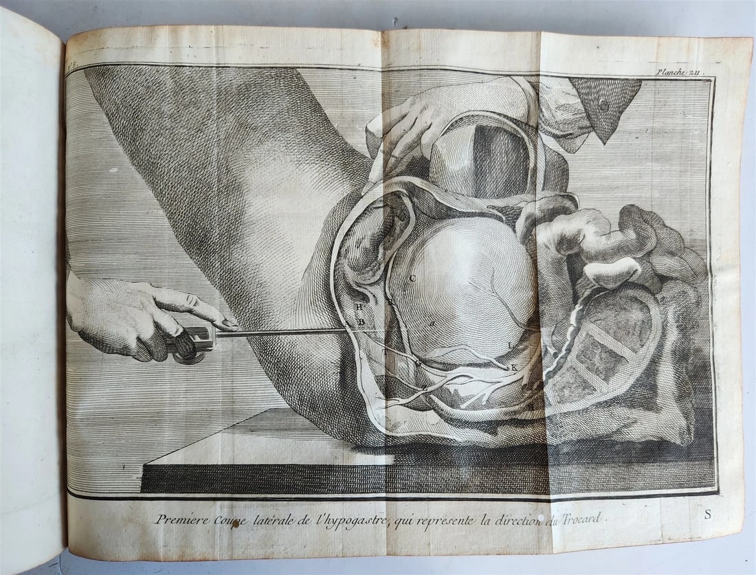1770 MEDICAL TREATISE ILLUSTRATED ANATOMY by Francois PLANQUE antique V. 10 - 8
