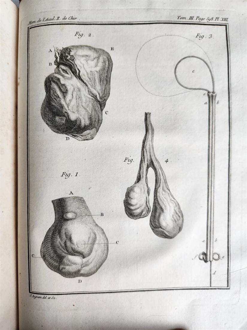 1753 SURGERY ANATOMY ILLUSTRATED antique Memoires l'Academie Royale de Chirurgie - 20