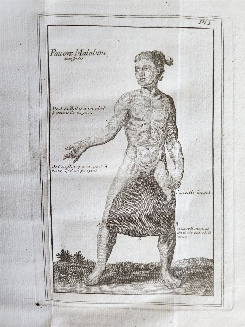 1748 MEDICAL TREATISE ILLUSTRATED ANATOMY by Francois PLANQUE antique V. 1 (1 of 20)
