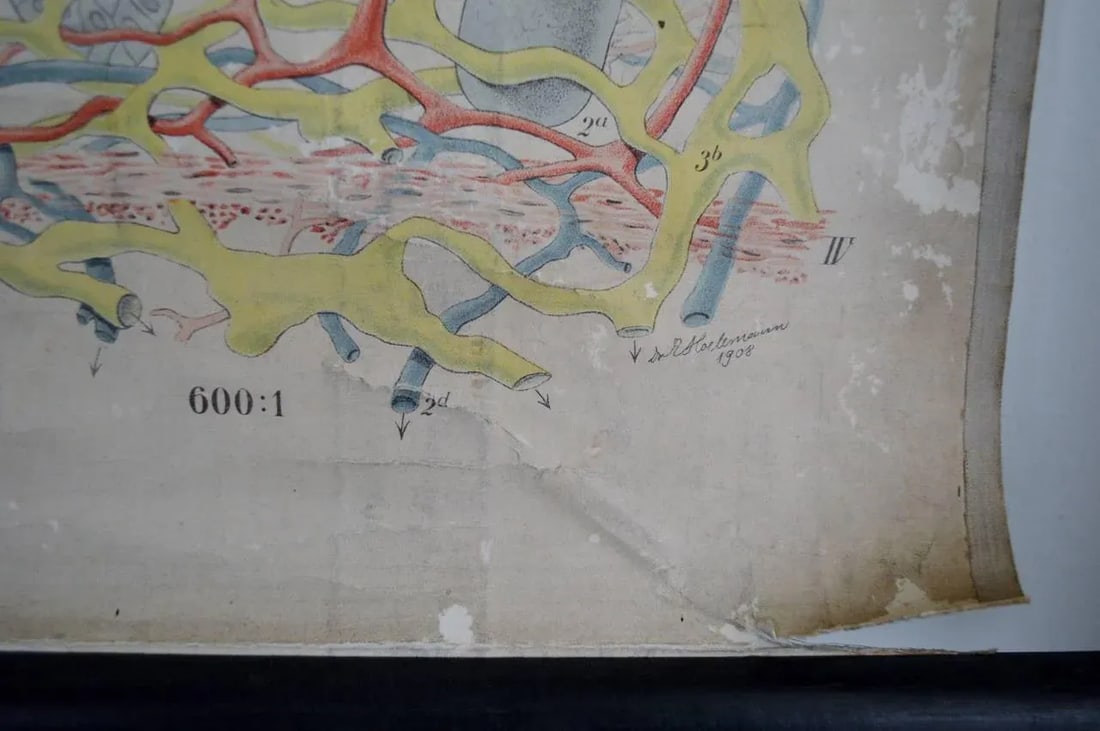 Vintage Swedish E. Hoelemann Antique Anatomical Chart - 5