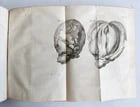 1752 MEDICAL TREATISE ILLUSTRATED ANATOMY by Francois PLANQUE antique V. 7 - 10