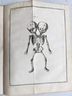 1752 MEDICAL TREATISE ILLUSTRATED ANATOMY by Francois PLANQUE antique V. 7 (1 of 16)