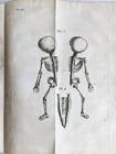 1752 MEDICAL TREATISE ILLUSTRATED ANATOMY by Francois PLANQUE antique V. 7 - 2