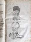 1704 ANATOMY MUSCLE TREATISE antique AMAZINGLY ILLUSTRATED - 10