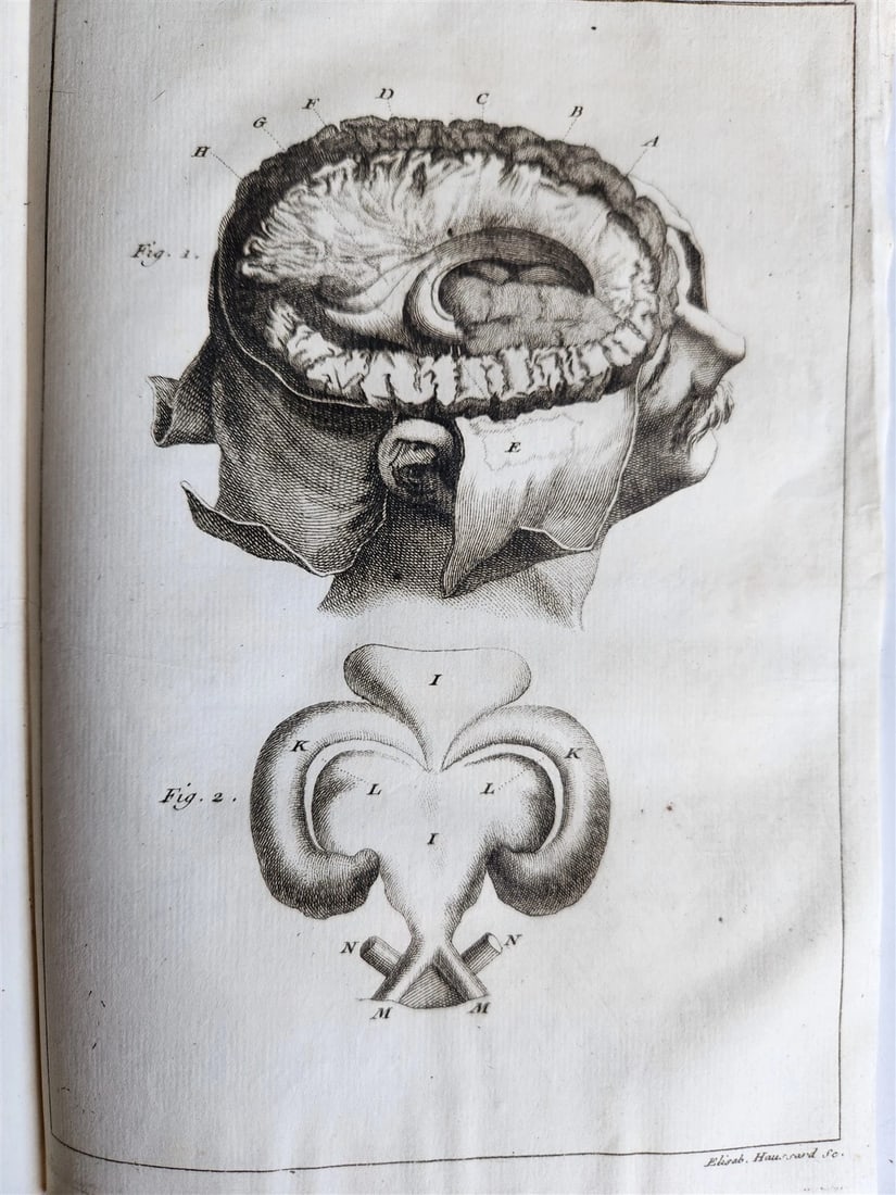 1750 MEDICAL TREATISE ILLUSTRATED ANATOMY by Francois PLANQUE antique V. 3 - 10