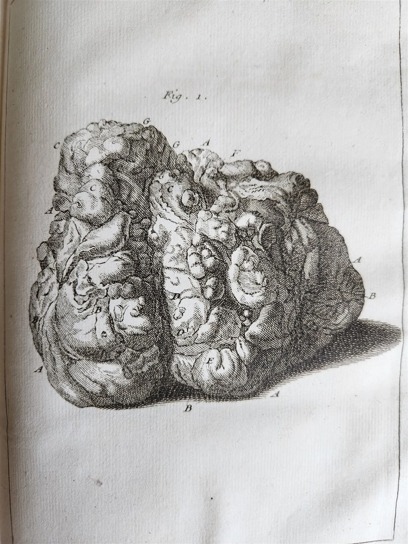 1750 MEDICAL TREATISE ILLUSTRATED ANATOMY by Francois PLANQUE antique V. 3 - 11