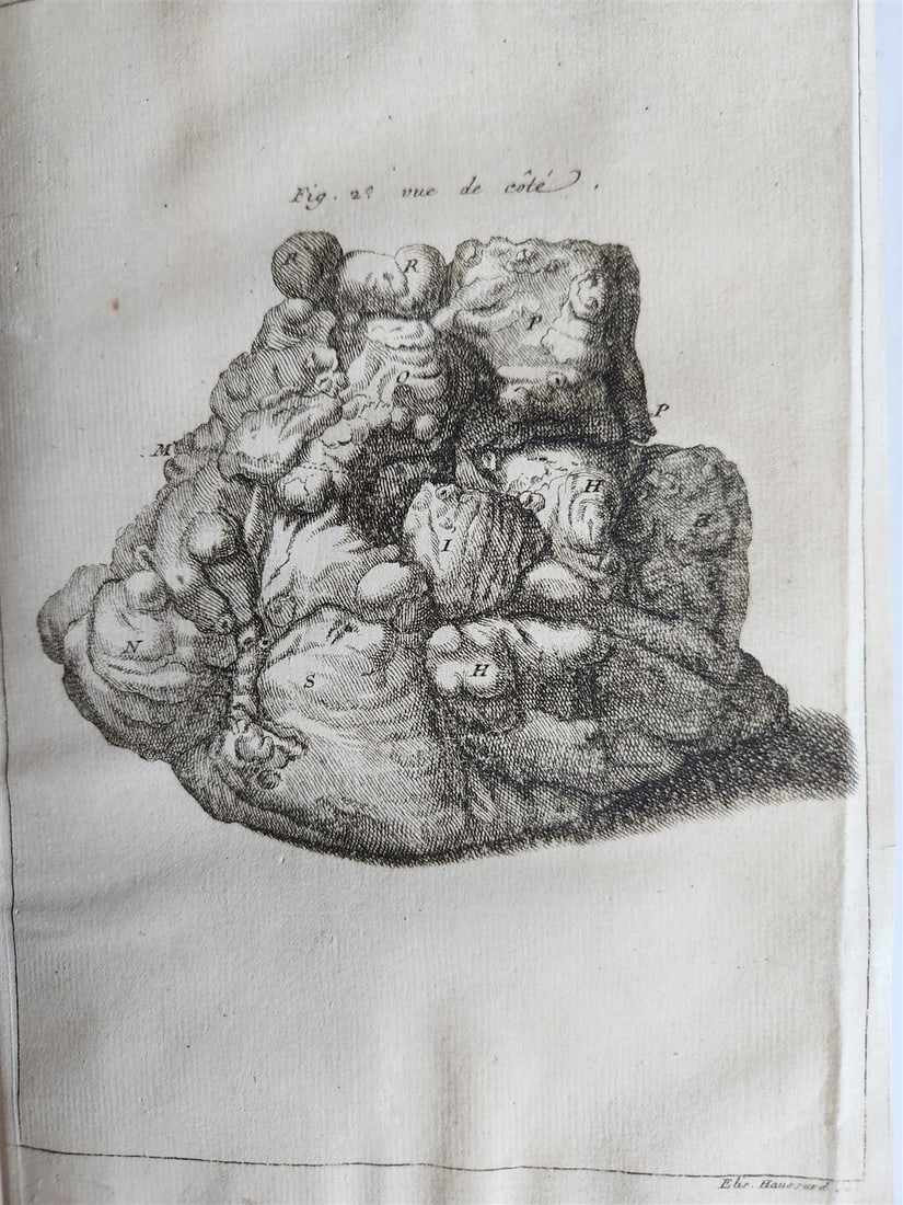 1750 MEDICAL TREATISE ILLUSTRATED ANATOMY by Francois PLANQUE antique V. 3 - 12