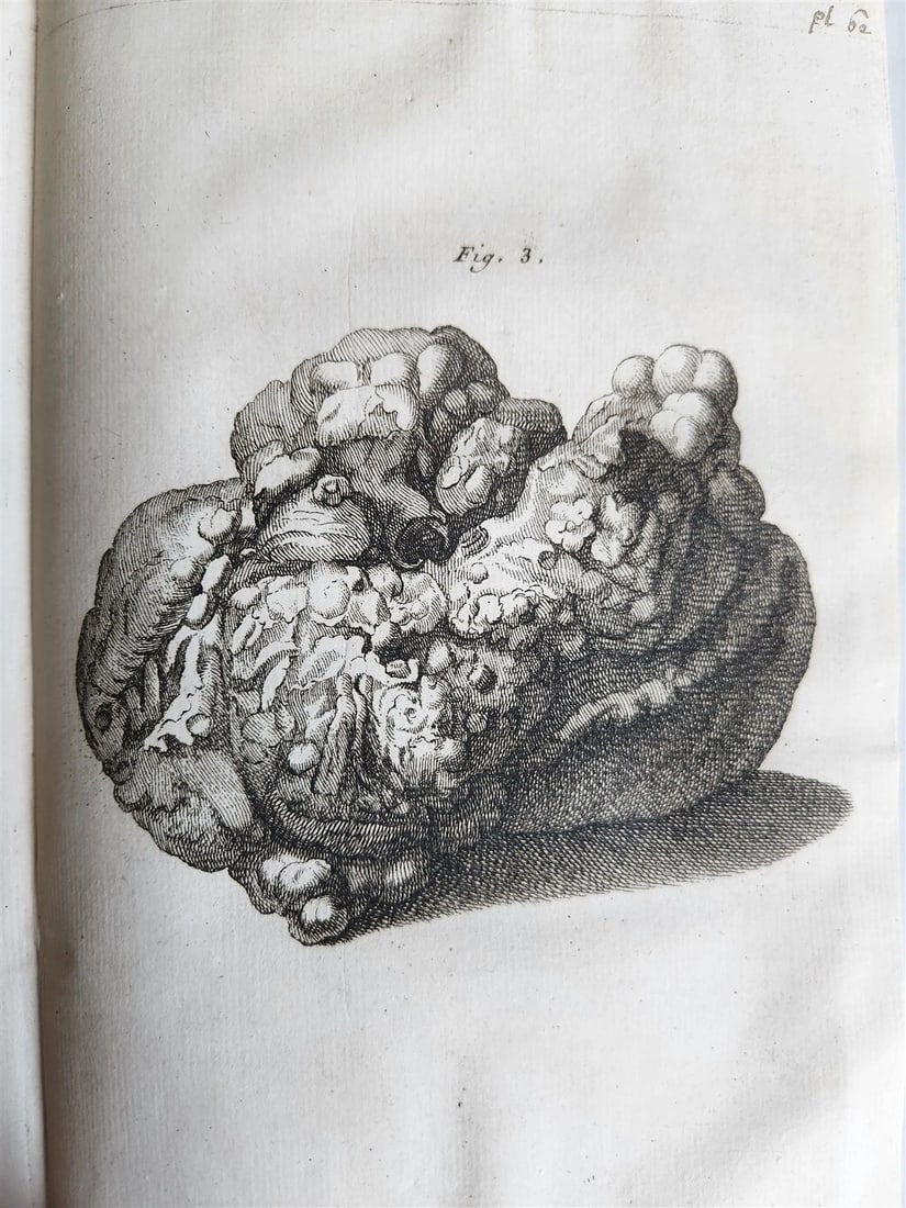 1750 MEDICAL TREATISE ILLUSTRATED ANATOMY by Francois PLANQUE antique V. 3 - 13