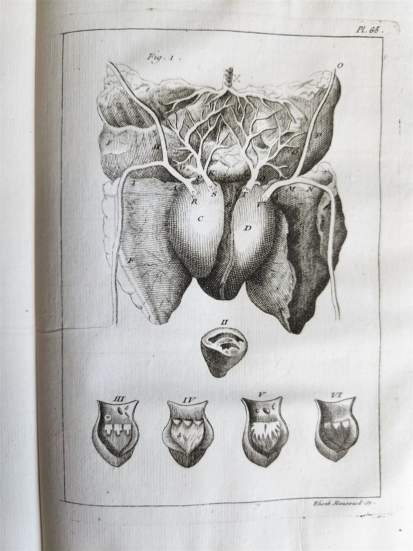 1750 MEDICAL TREATISE ILLUSTRATED ANATOMY by Francois PLANQUE antique V. 3 - 16