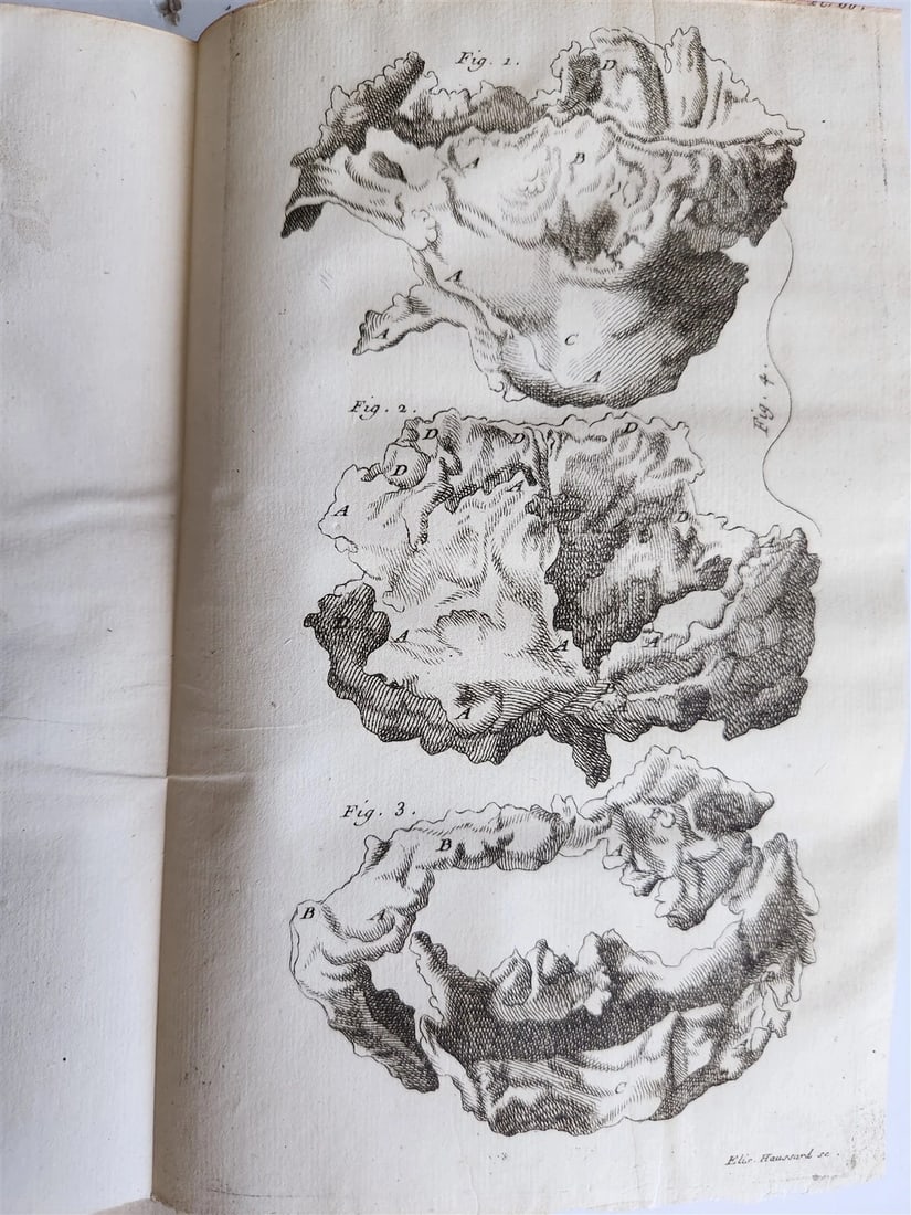 1750 MEDICAL TREATISE ILLUSTRATED ANATOMY by Francois PLANQUE antique V. 3 - 19