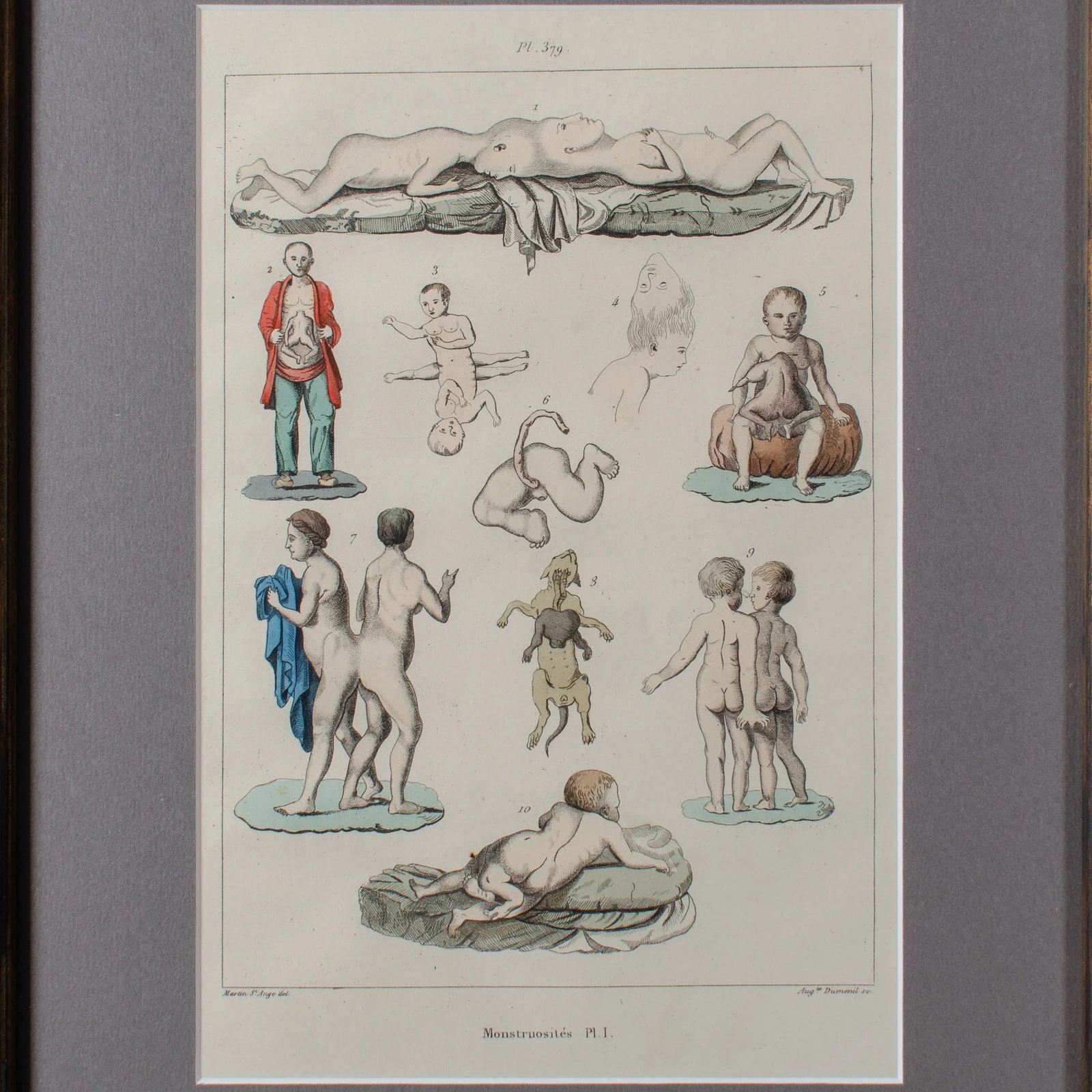 Monstruosites, Engravings From Isidore Geoffrey Sainte-Hilaire, Paris C. 1832 - Set of 4 - 10