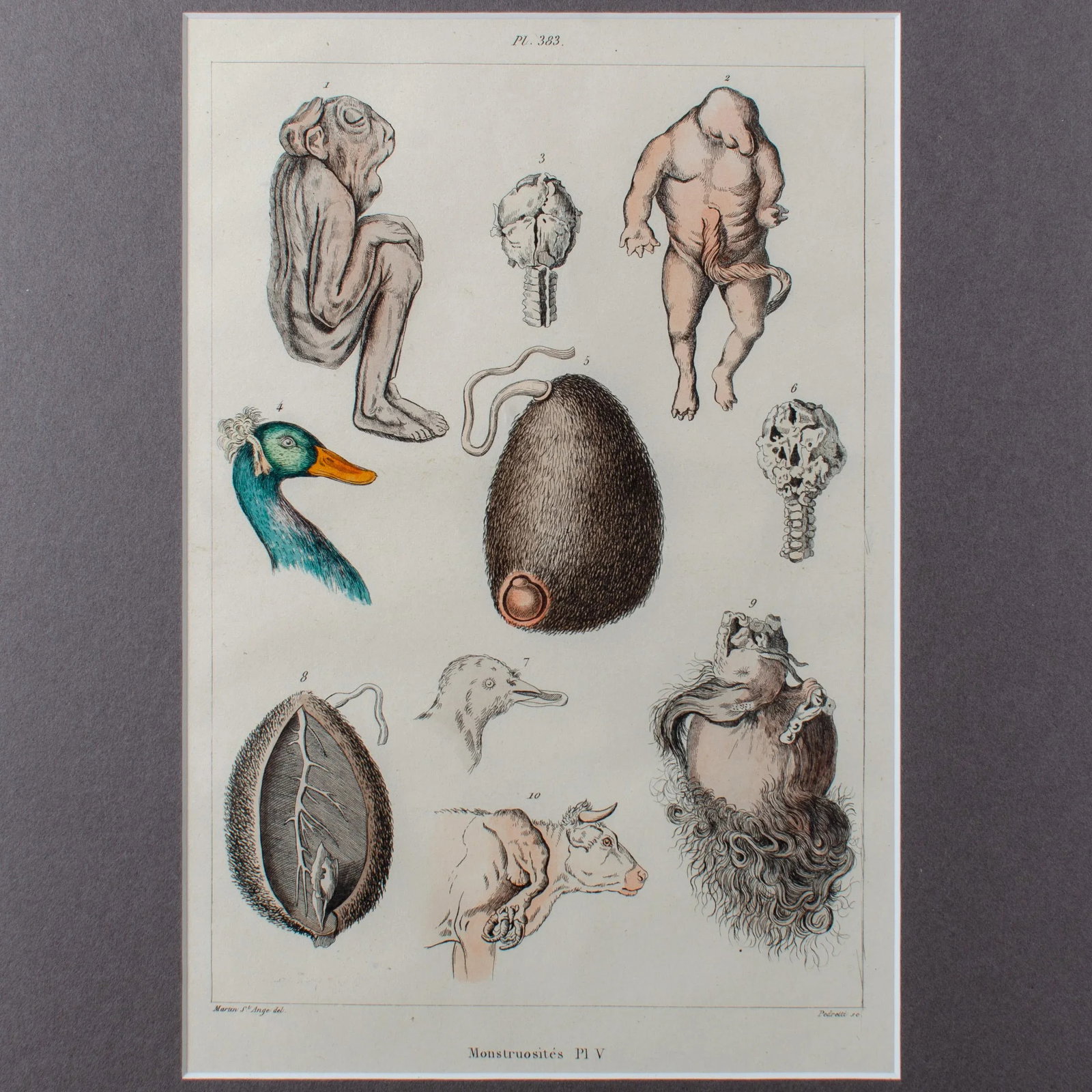 Monstruosites, Engravings From Isidore Geoffrey Sainte-Hilaire, Paris C. 1832 - Set of 4 - 11