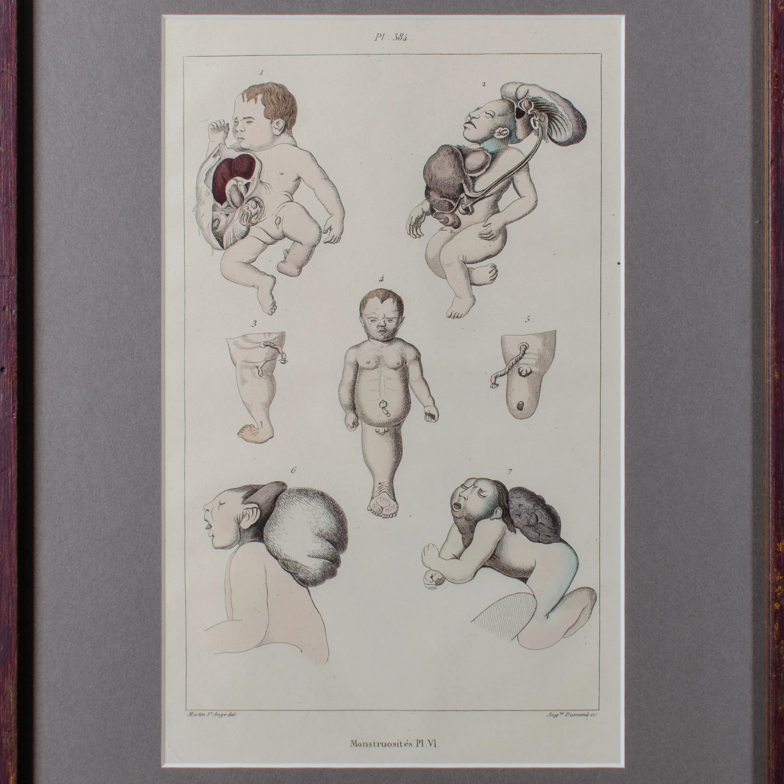 Monstruosites, Engravings From Isidore Geoffrey Sainte-Hilaire, Paris C. 1832 - Set of 4 - 12