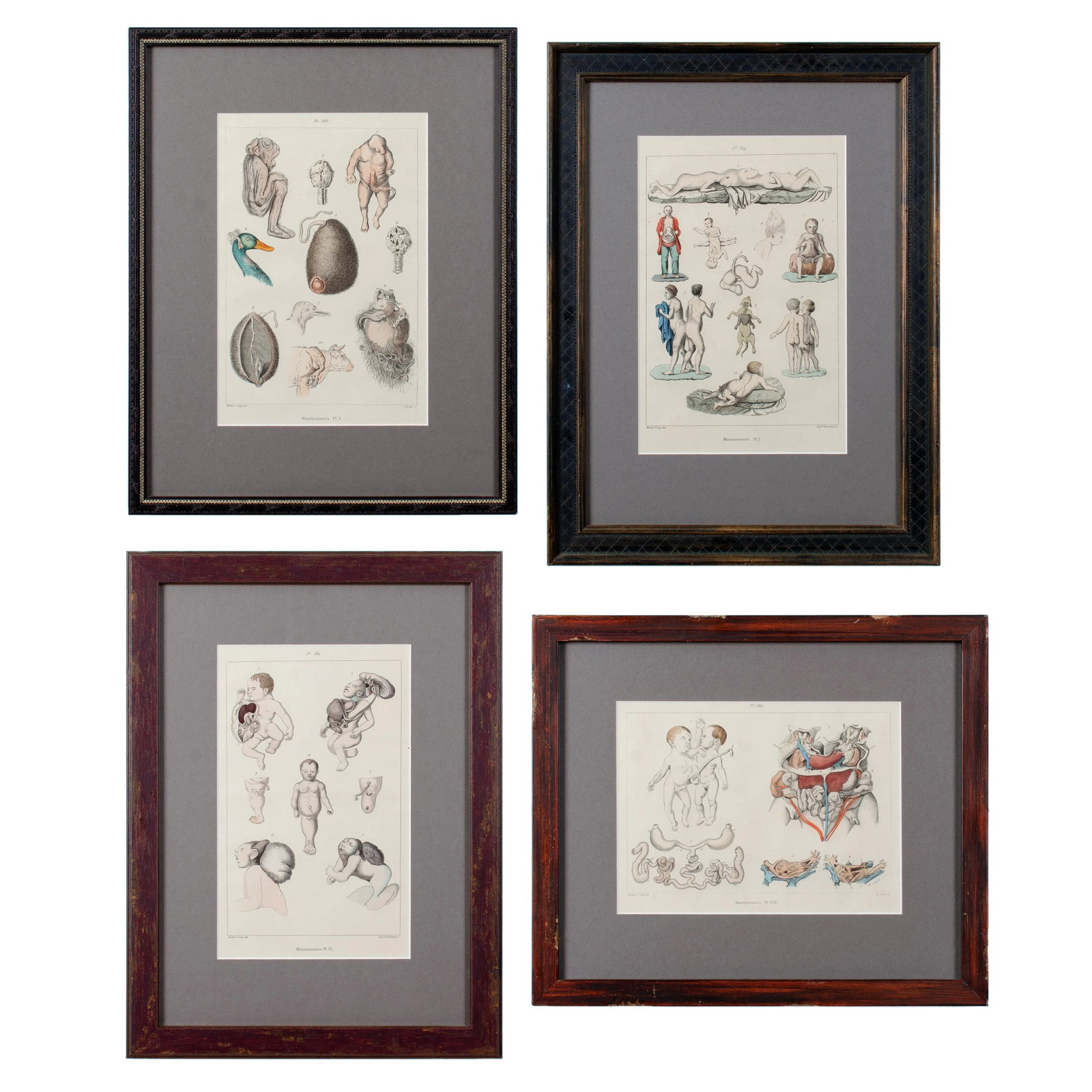 Monstruosites, Engravings From Isidore Geoffrey Sainte-Hilaire, Paris C. 1832 - Set of 4 - 13