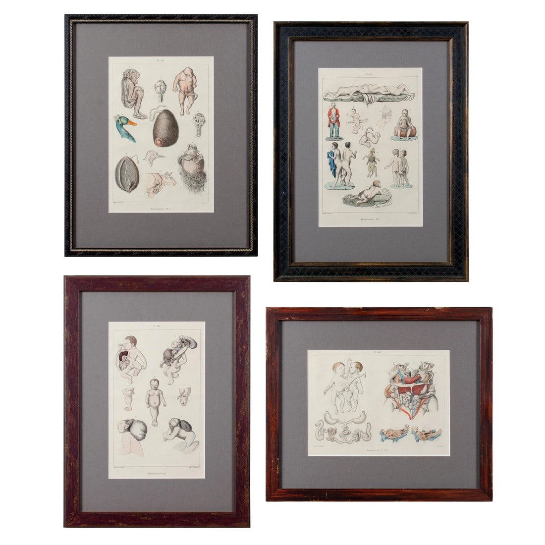 Monstruosites, Engravings From Isidore Geoffrey Sainte-Hilaire, Paris C. 1832 - Set of 4: Isidore Geoffroy Saint-Hilaire (French, 1805-1861) Offered is a set of four framed, hand-colored engravings from "Histoire générale et particulière des anomalies de l'organisation chez