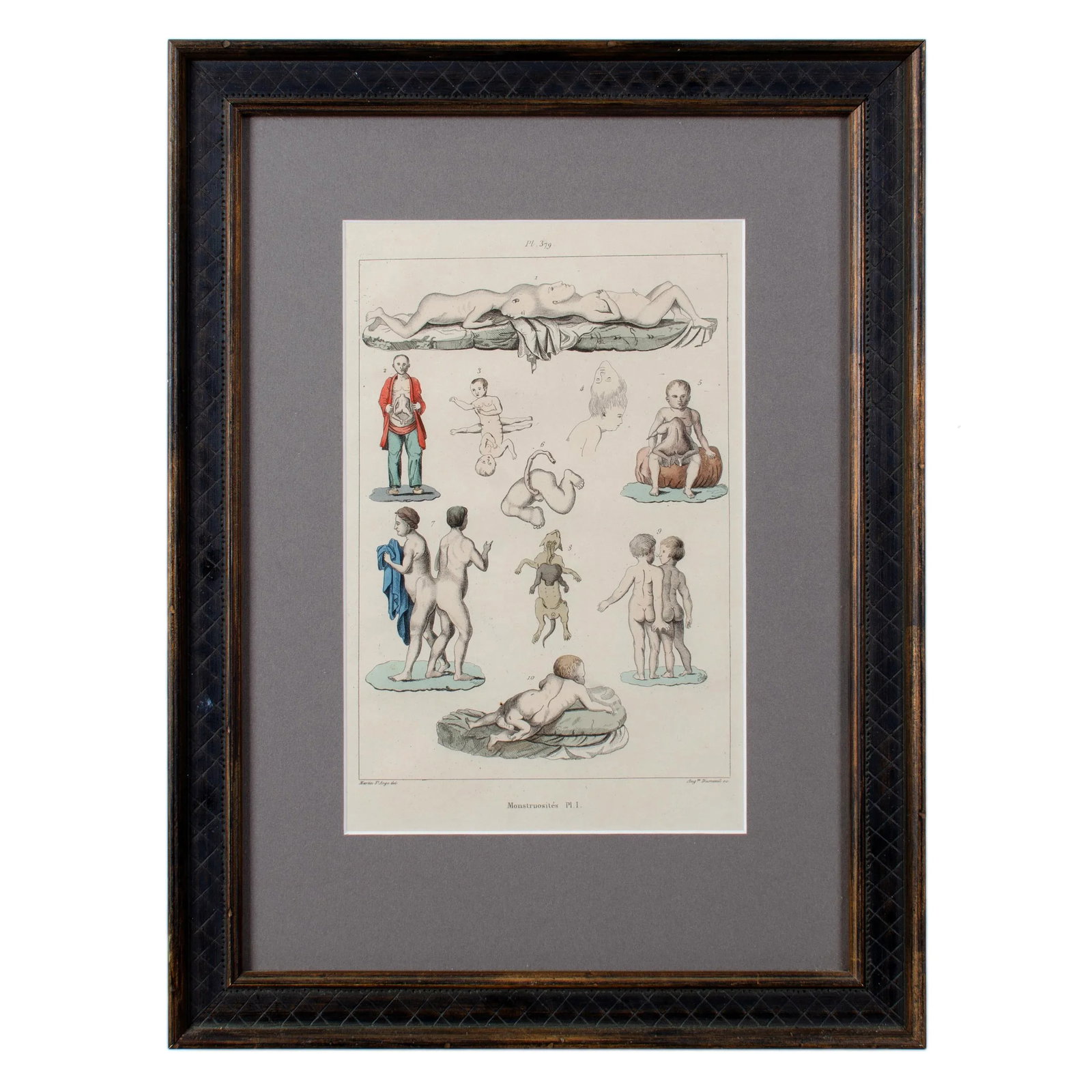 Monstruosites, Engravings From Isidore Geoffrey Sainte-Hilaire, Paris C. 1832 - Set of 4 - 3