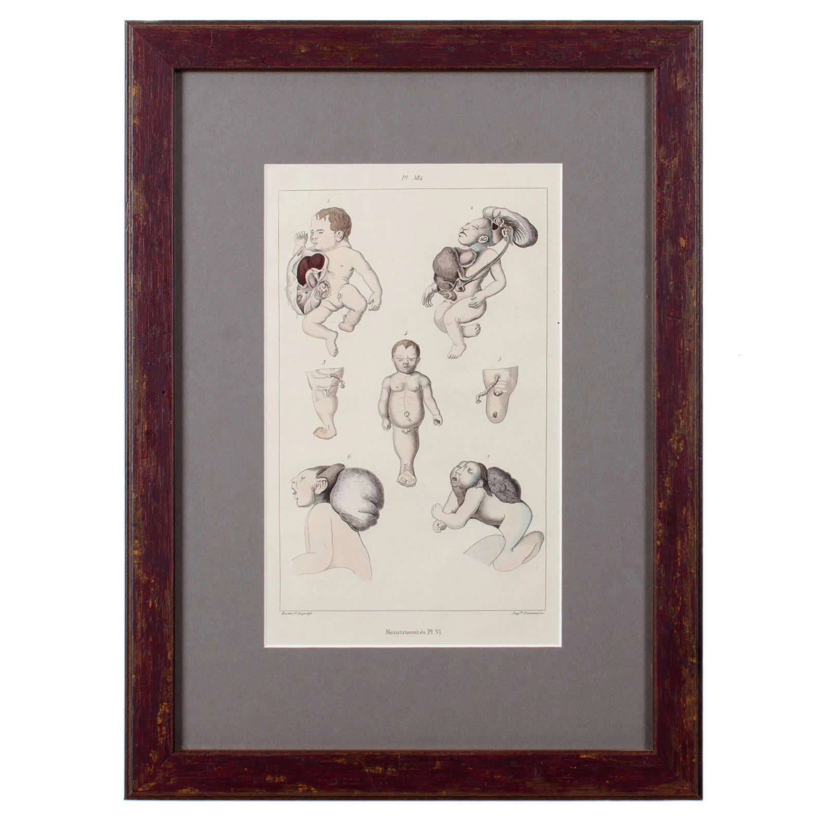Monstruosites, Engravings From Isidore Geoffrey Sainte-Hilaire, Paris C. 1832 - Set of 4 - 8