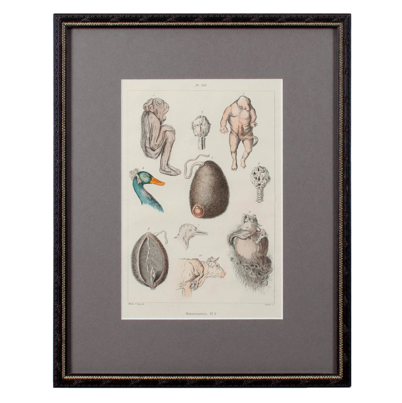 Monstruosites, Engravings From Isidore Geoffrey Sainte-Hilaire, Paris C. 1832 - Set of 4 - 9