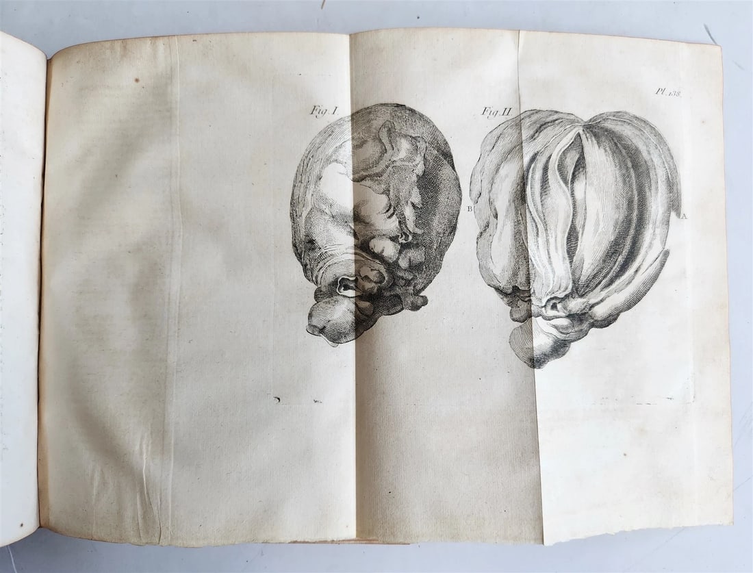 1752 MEDICAL TREATISE ILLUSTRATED ANATOMY by Francois PLANQUE antique V. 7 - 10