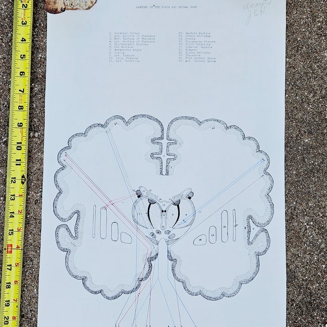 Vintage Pull-down Canvas Neuro Chart entitled "Anatomy of the Brain and Spinal Cord" - 3