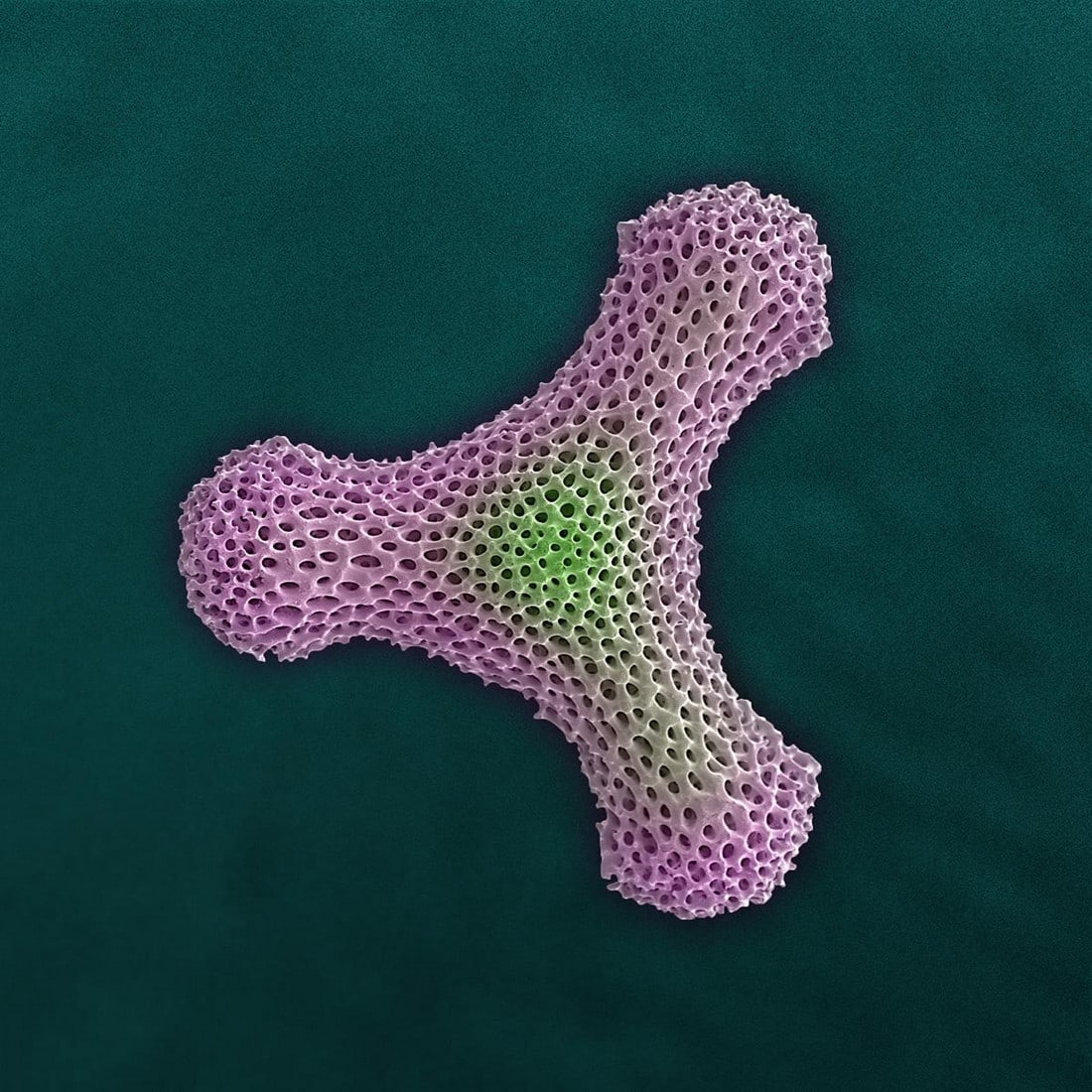 Fidget Radiolarian Digital Painting by Modernist Andrew Leonard: Photographer, Andrew Paul Leonard, uses the scanning electron microscope to explore "inner- space" as another fronitier. His ability to capture the seldom seen beauty of a previously unimagined world