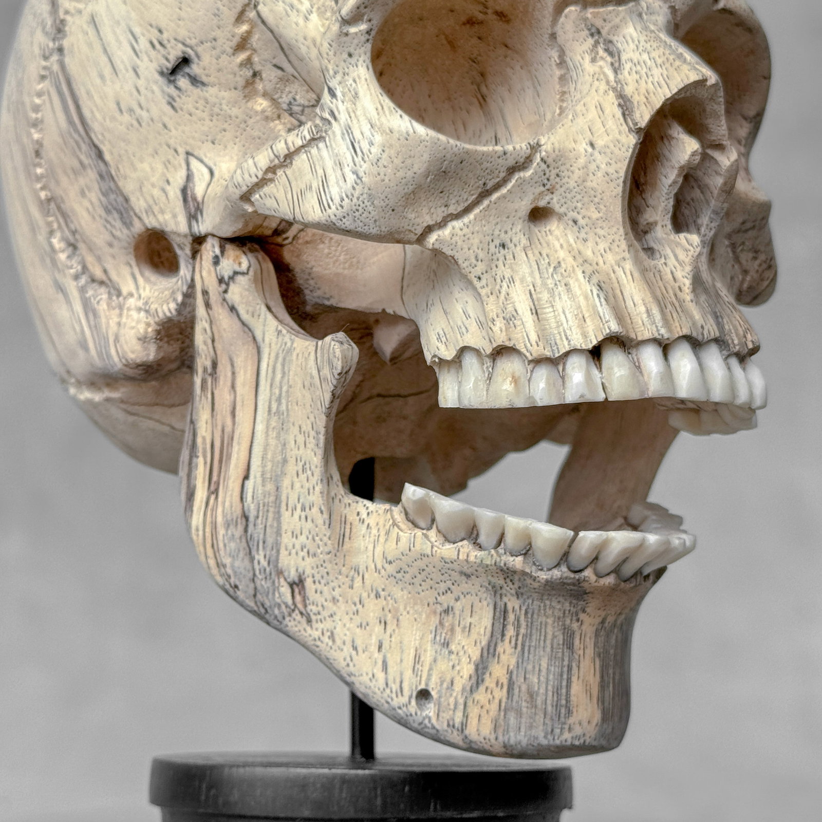 Wonderful human skull with a beautiful grain on a custom stand - 10