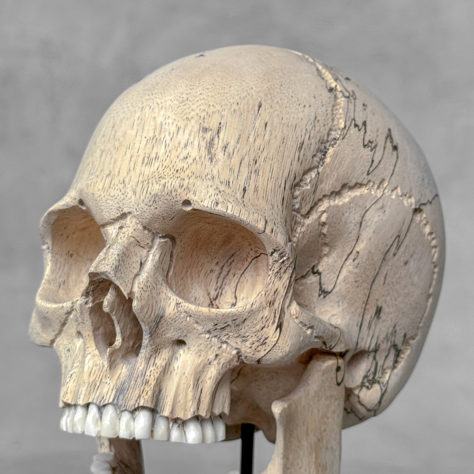 Wonderful human skull with a beautiful grain on a custom stand - 3