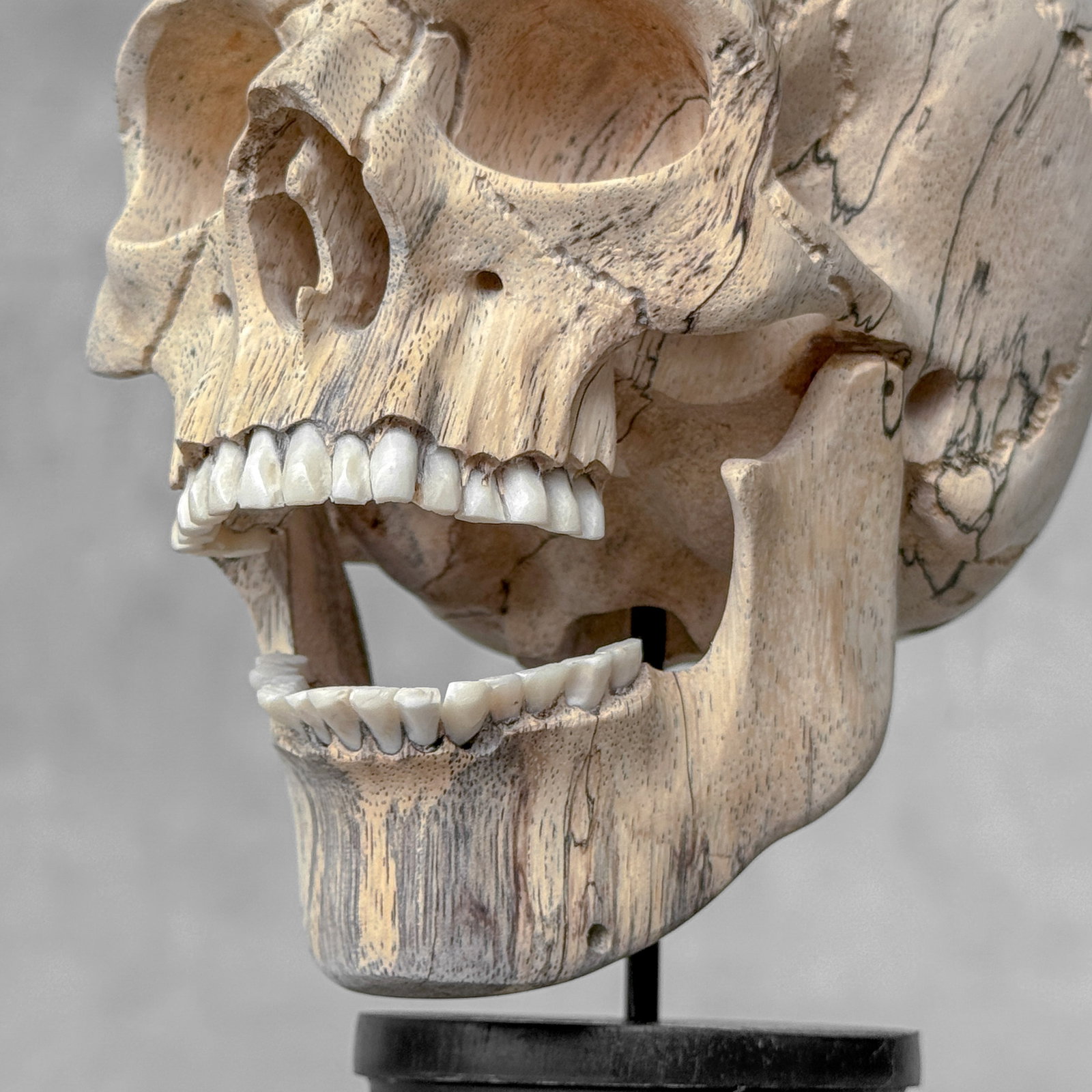 Wonderful human skull with a beautiful grain on a custom stand - 4