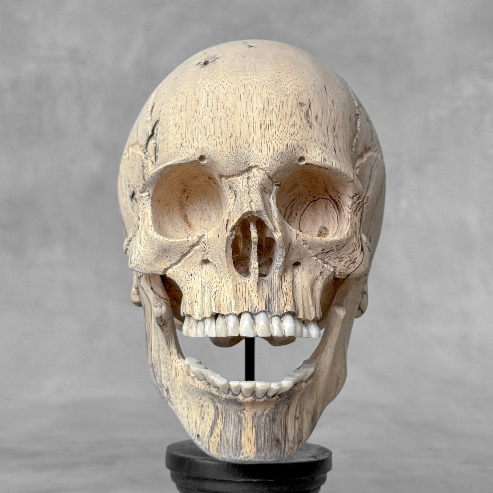 Wonderful human skull with a beautiful grain on a custom stand - 5