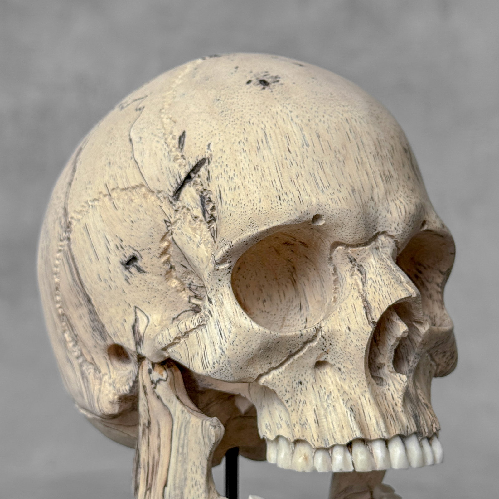 Wonderful human skull with a beautiful grain on a custom stand - 9