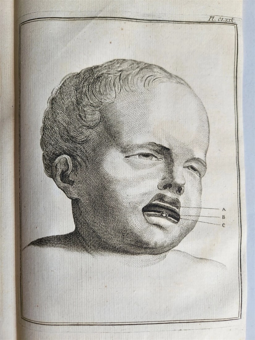 1763 MEDICAL TREATISE ILLUSTRATED ANATOMY by Francois PLANQUE antique V. 8: Francois PLANQUE Bibliotheque choisie de medecine, tiree des ouvrages periodiques, tant francois qu'etrangers. Avec plusieurs autres pieces rares & des remarques utiles et curieuses. (Selected Library