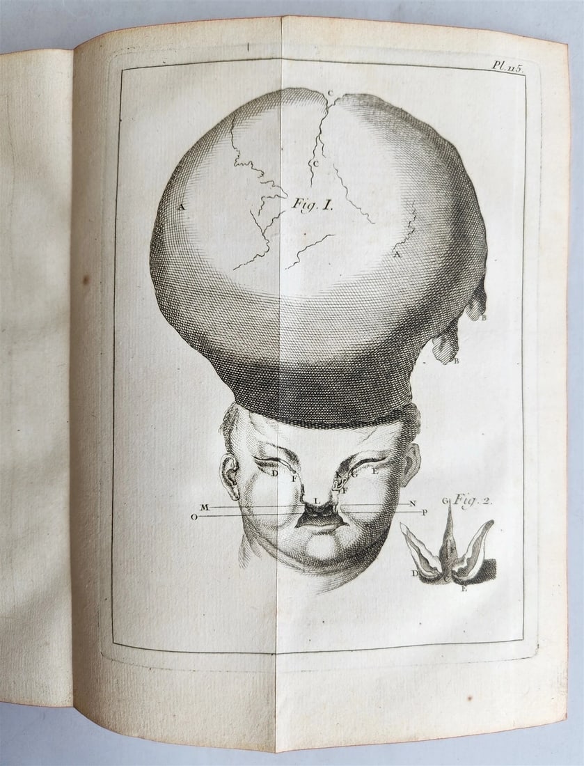 1761 MEDICAL TREATISE ILLUSTRATED ANATOMY by Francois PLANQUE antique V.6 (1 of 20)