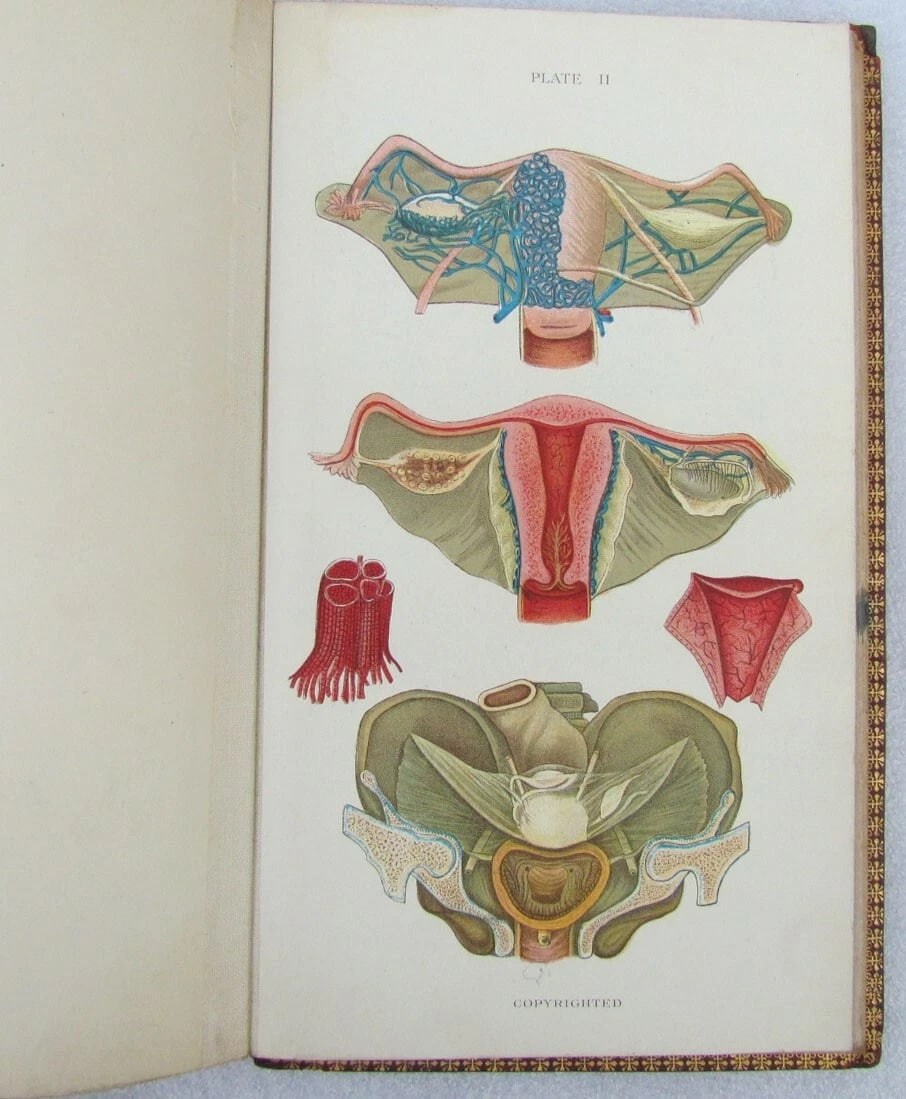 1909 GYNECOLOGICAL PLATES antique leather bound - 7